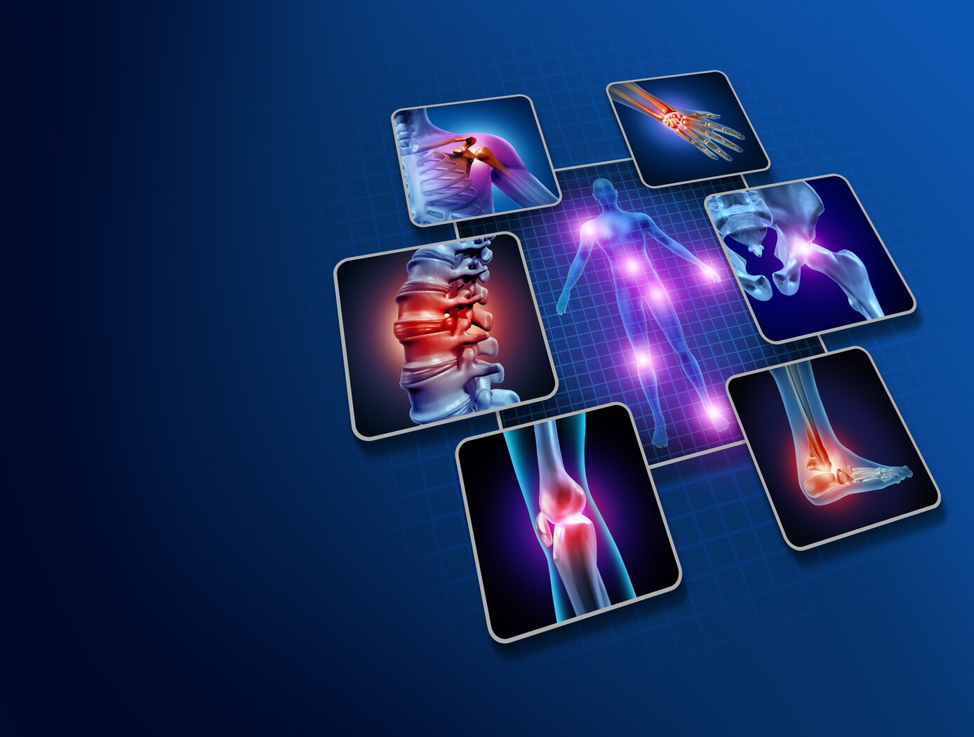 Illustrated graphic of various joints in the human body